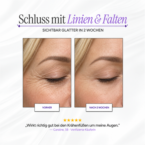Glatelle™ Silikon-Kollagen-Tape